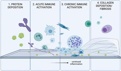 Mobilizing Endogenous Repair Through Understanding Immune Reaction With Biomaterials